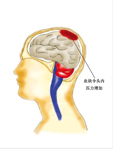 营收、净利双双创近4个季度新高，容百科技海外销售高增长